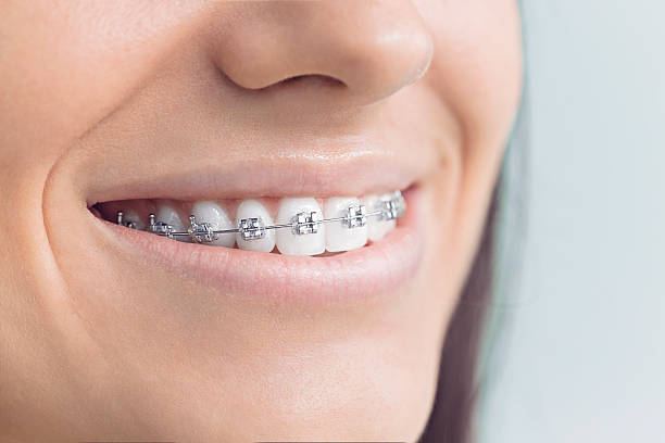 Best Invisalign and Clear Aligners  in Mercer, PA